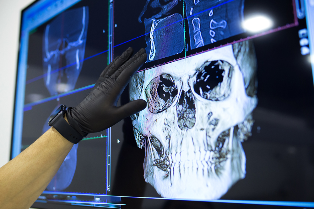 Foto - Erwachsene - Kombi Kieferorthopaedie und Kieferchirurgie​